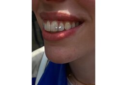 Nieuw bij Kingdom Tattoo & Piercing Alkmaar: Toothgems