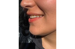 Nieuw bij Kingdom Tattoo & Piercing Alkmaar: Toothgems